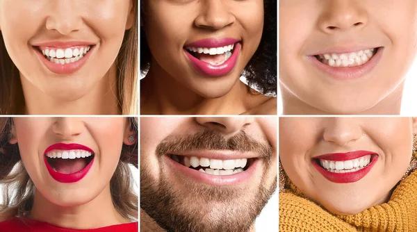 Signs You Need a Dental Crown Glendale and What to Expect